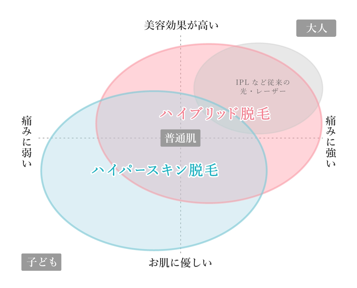 「ハイパースキン脱毛」と「ハイブリッド脱毛」の特徴についての図