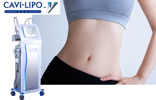 CAVI-LIPO - V